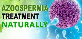 The Treatment for Non-Obstructive Azoospermia
