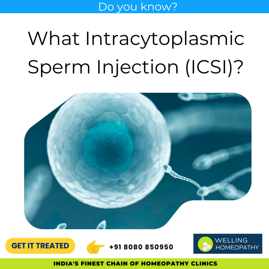 What Intracytoplasmic Sperm Injection (ICSI)?