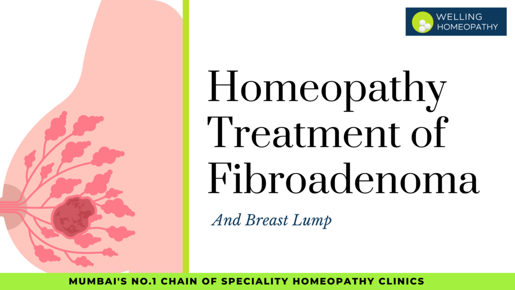 Homeopathy Treatment of Fibroadenoma