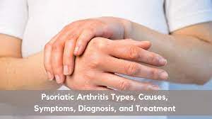 Homeopathy treatment of Psoriatic Arthritis