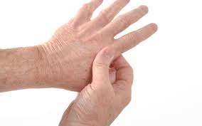 Homeopathy Treatment of Rheumatoid Arthritis