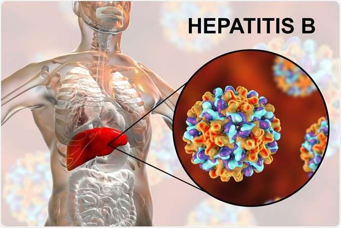 Treatment of Hepatitis B