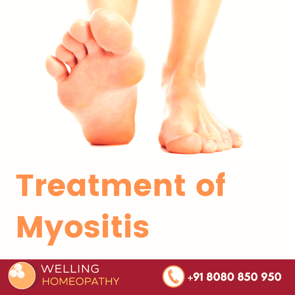 Treatment of Myositis