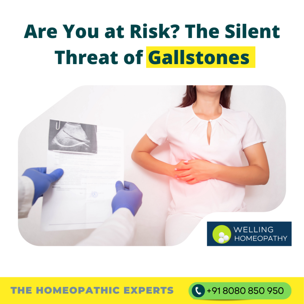 Treatment for Gallstones