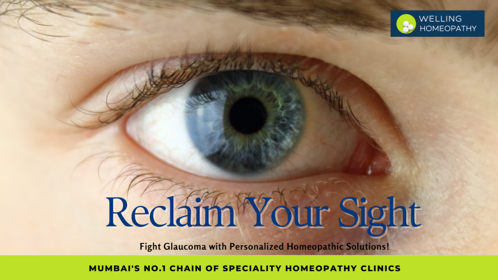 Glaucoma and Homeopathy Remedies A Comprehensive Overview