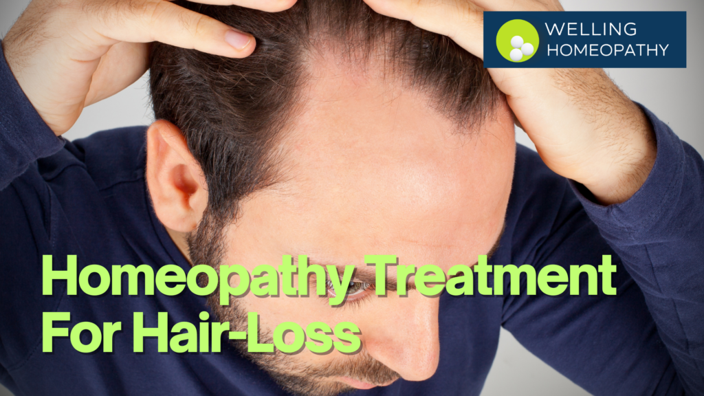 Homeopathy Treatment For HairLoss