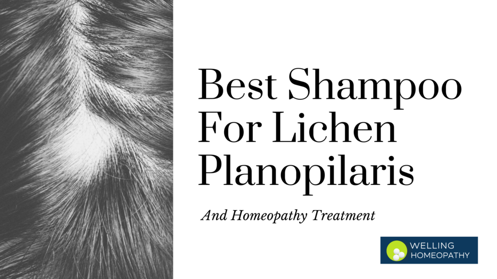 Homeopathy Treatment for Lichen Planopilaris