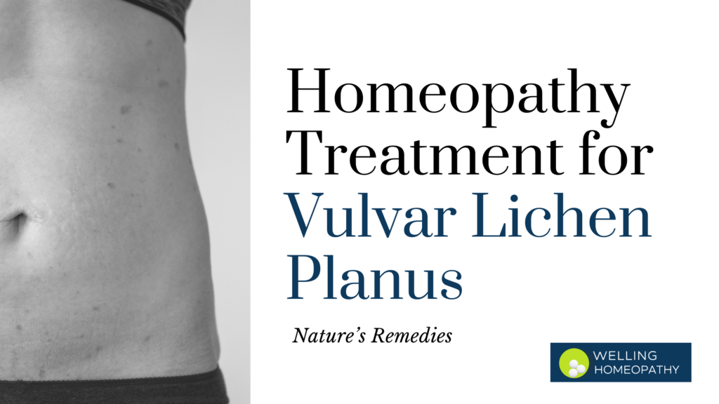 Homeopathy Treatment for Vulvar Lichen Planus